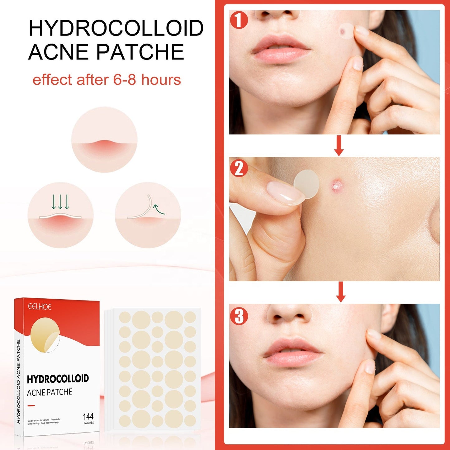 EELHOE Hydrocolloid Pimple Patch (PCS 144)