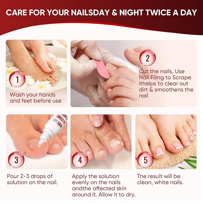 Dermfree Fungi Nail Treatment Liquid