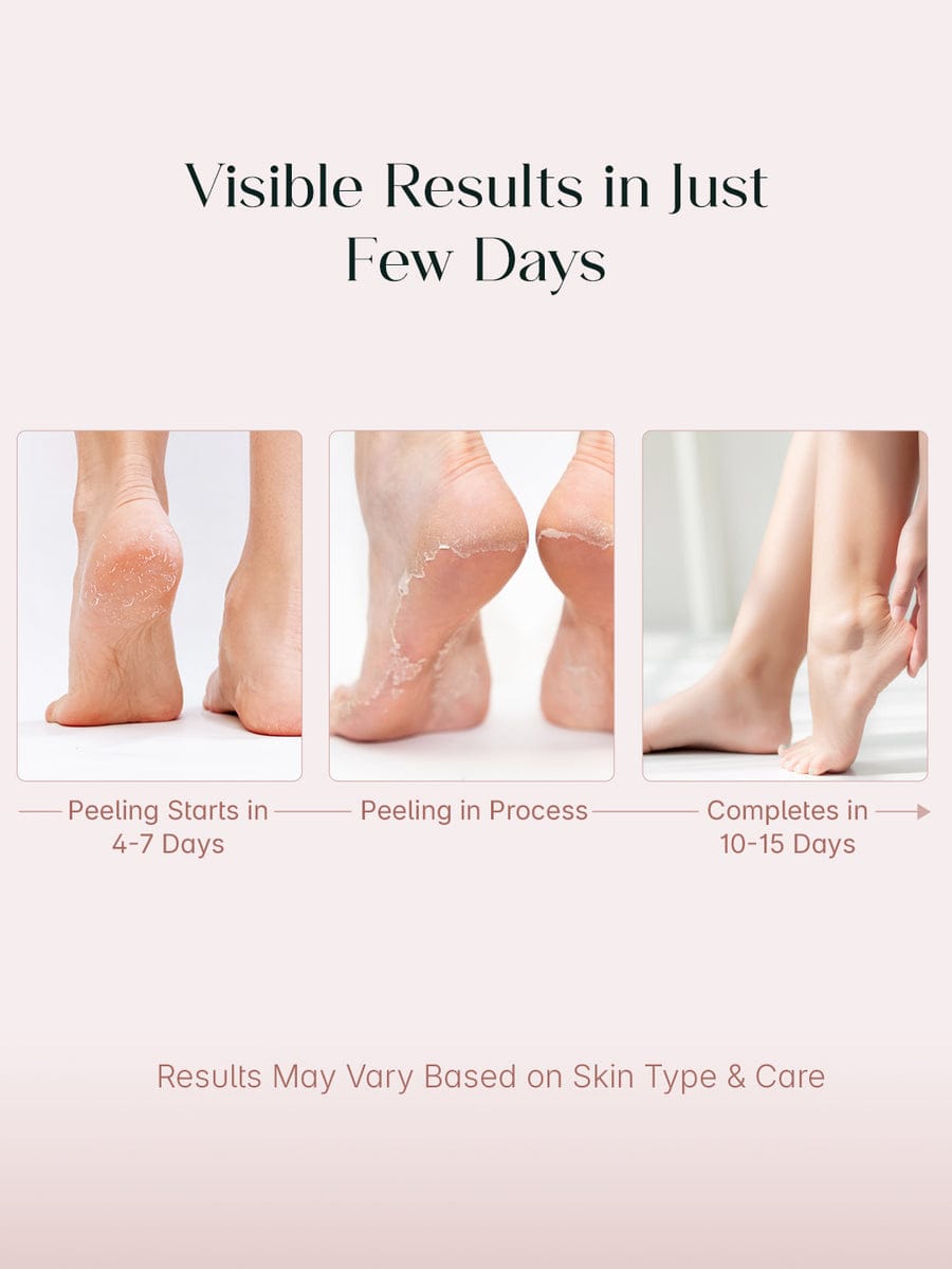 Foot  Peeling Mask