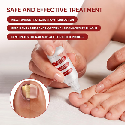 Dermfree Fungi Nail Treatment Liquid