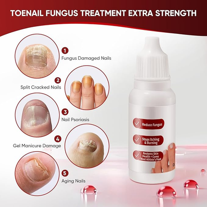 Dermfree Fungi Nail Treatment Liquid