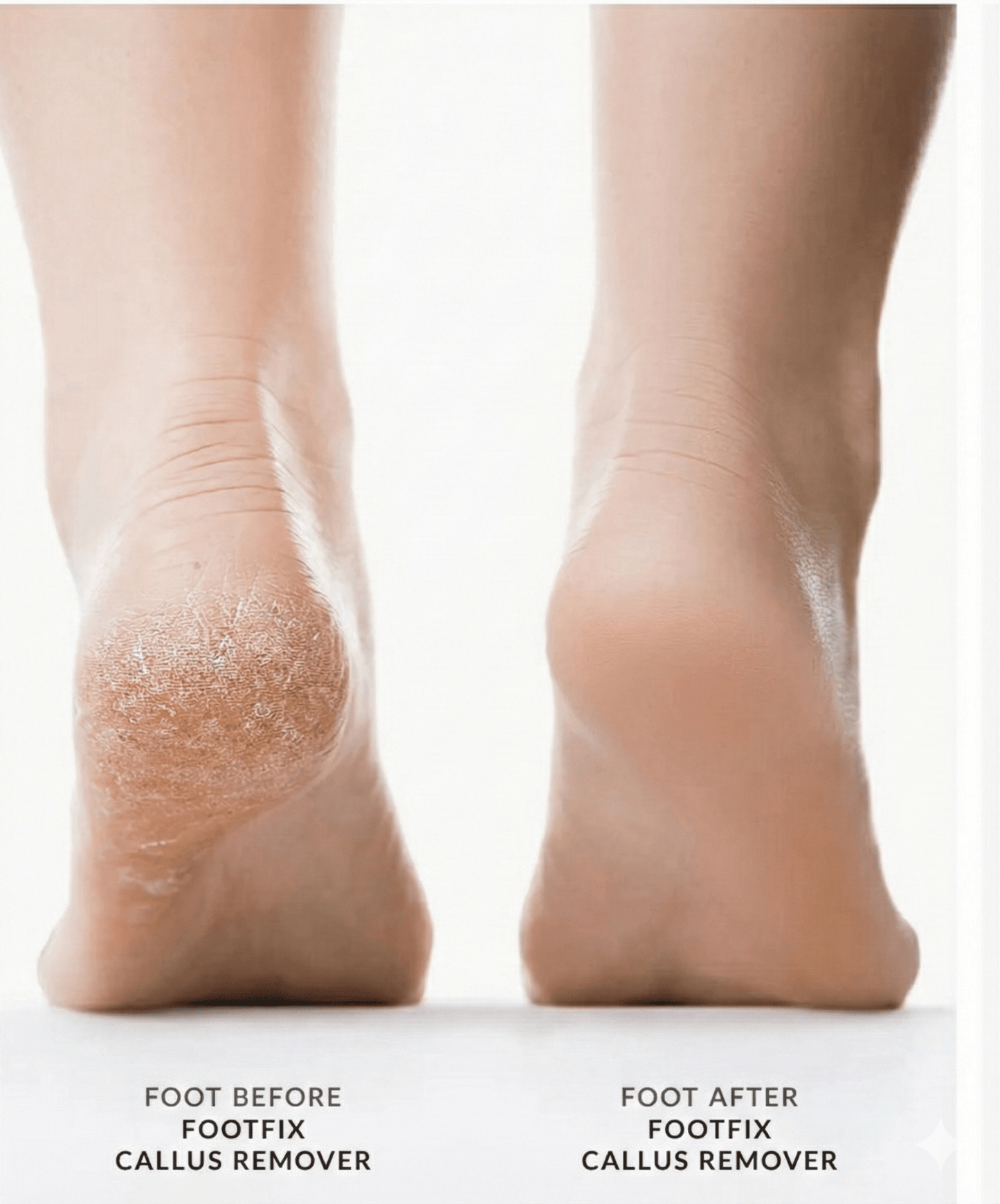Danzoo™ Callus Remover